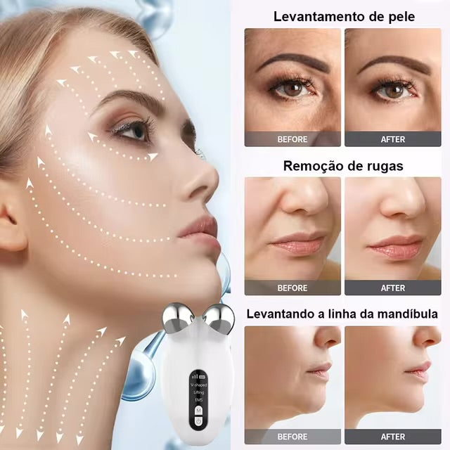 Face-Beauty Roller