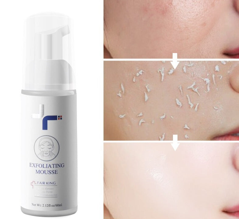 Espuma Esfoliante